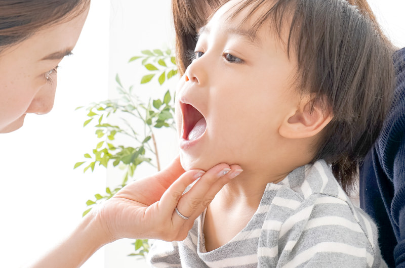 歯並びを整える小児矯正の取り組み